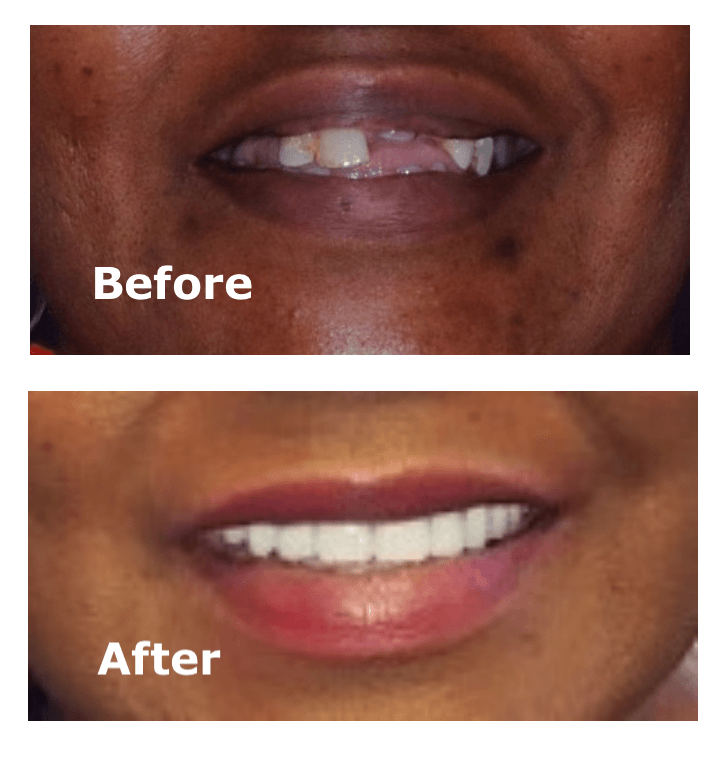 Dental Brookline MA | Same-Day Smile Restoration MA | Brookline Dental