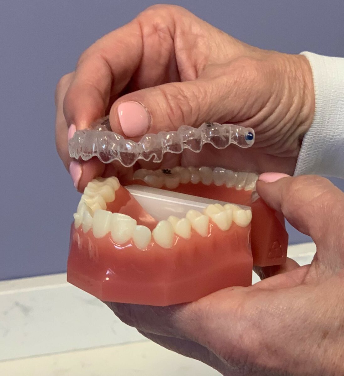 We Have Vivera! Clear Retainers from Invisalign - Brookline Dental ...